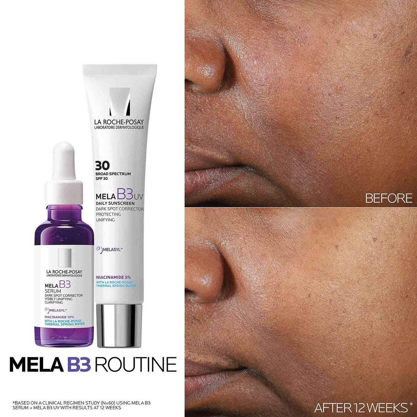 mela-b3-uv-daily-moisturizer-spf-30-with-melasyltm-niacinamide-m1 Mela-B3-routine_1500X1500.jpg
