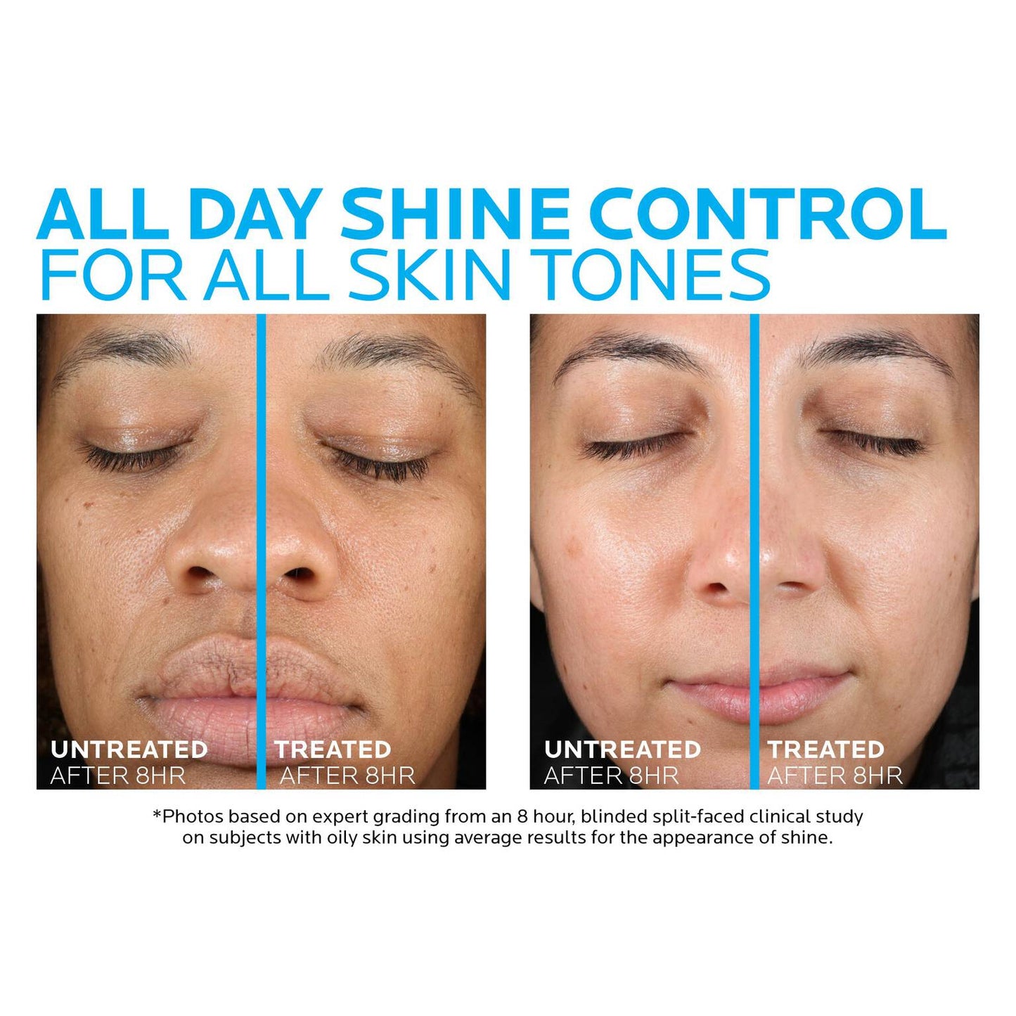 toleriane-double-repair-matte-face-moisturizer-for-oily-skin-t4 la-roche-posay-toleriane-matte-moisturizer-before-and-after-pdp-alt.jpg